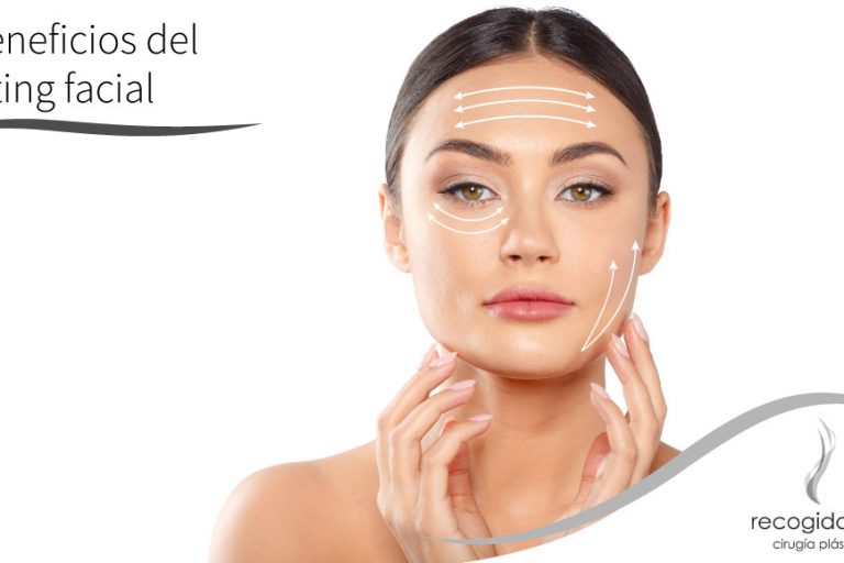 Beneficios del lifting facial
