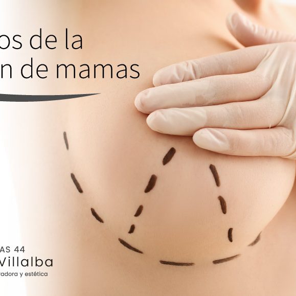 Beneficios de la elevación de mamas Beneficios de la elevación de mamas