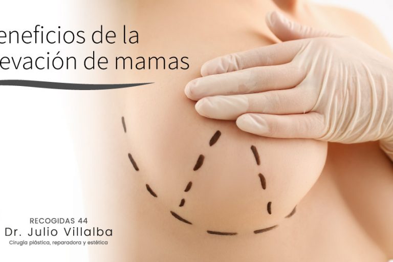 Beneficios de la elevación de mamas