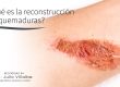 ¿Qué es la reconstrucción de quemaduras?